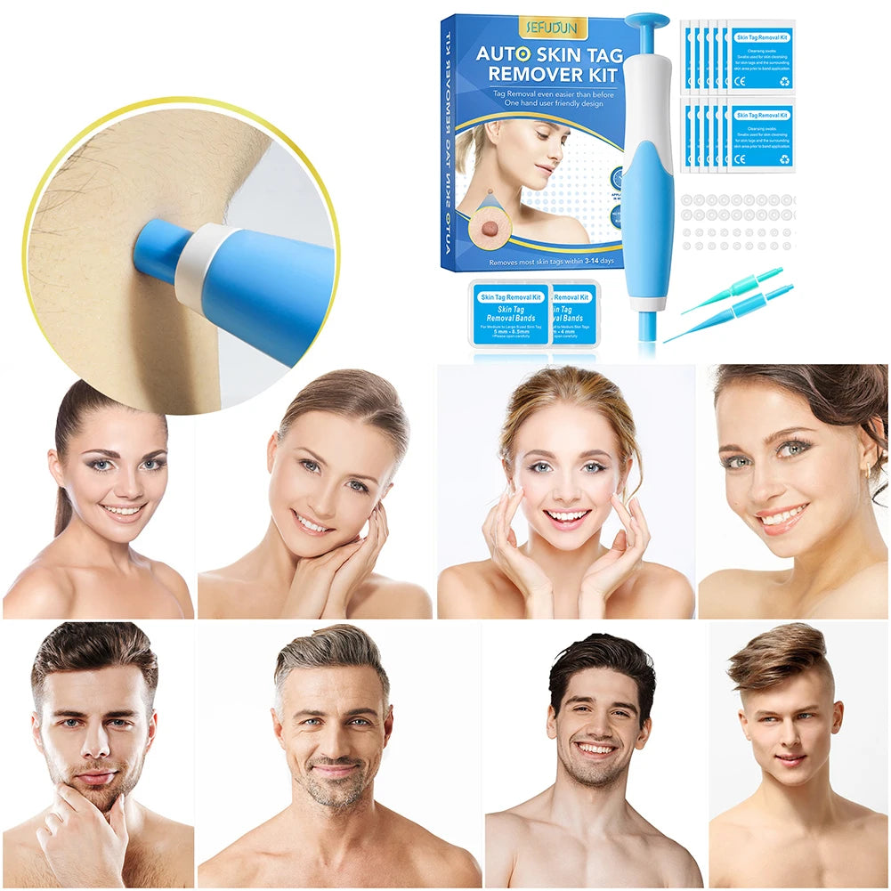 2 IN 1 Auto Micro Skin Tag Remover Device, Mole, Wart Remover Beauty Tools