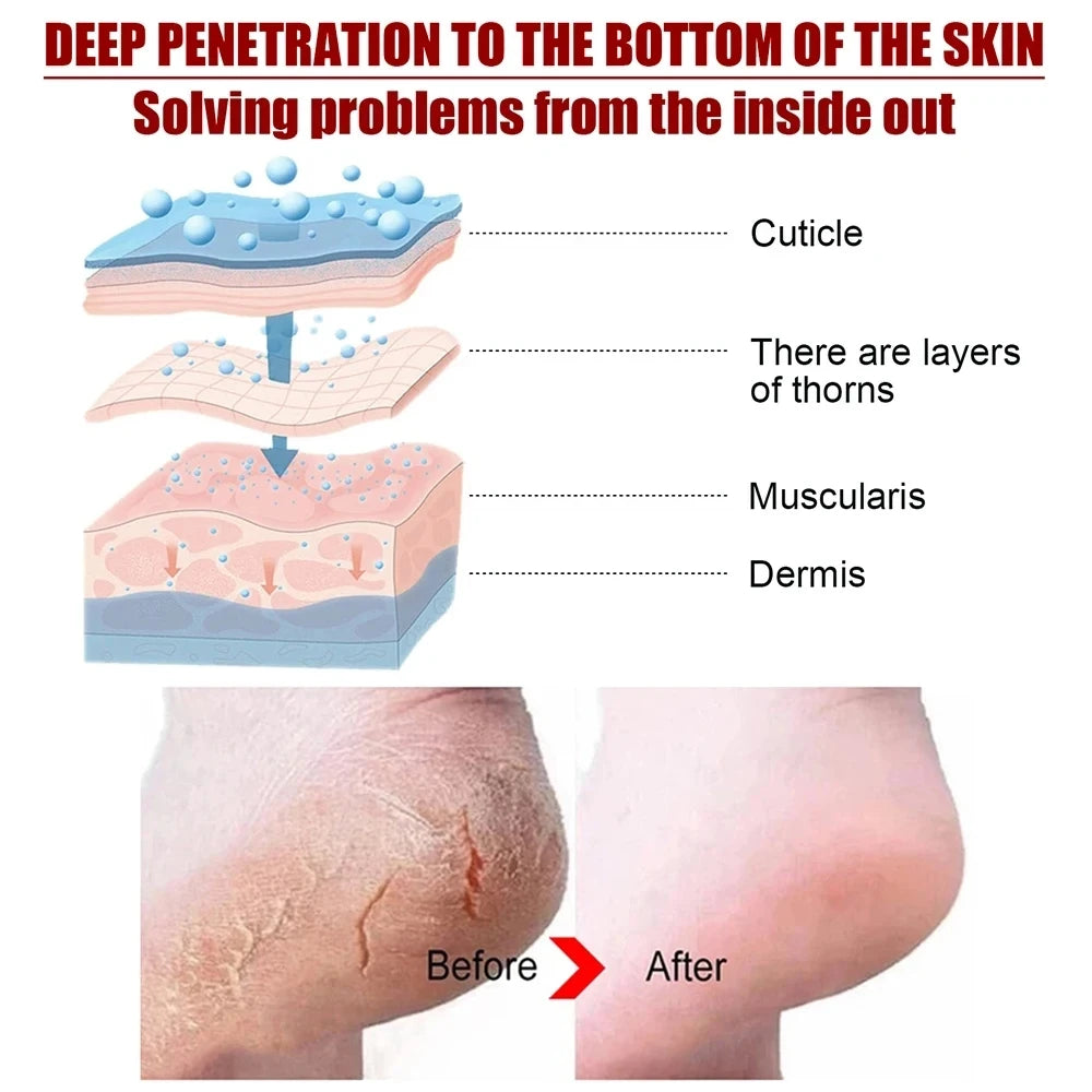 Foot Peeling Mask Repairs Heels & Removes Dry Dead Skin Exfoliating