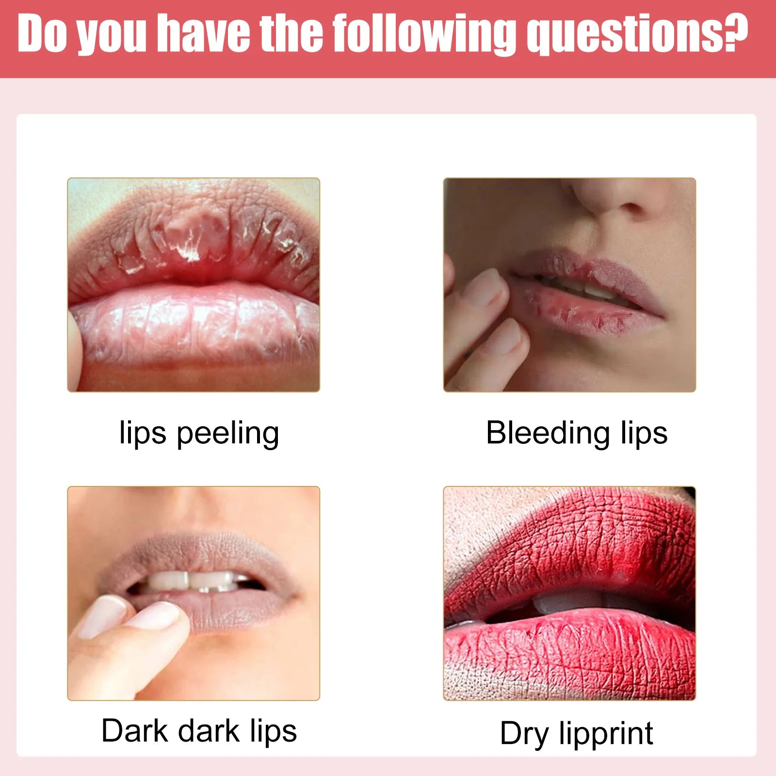 Lip Lightening Care Cream Dark Smoke Lip Removal, Moisturizing, Brighten Fade Lips Line, Anti Crack