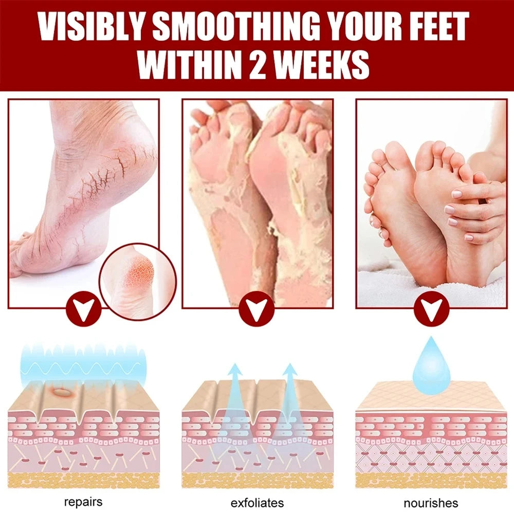 Foot Peeling Mask Repairs Heels & Removes Dry Dead Skin Exfoliating