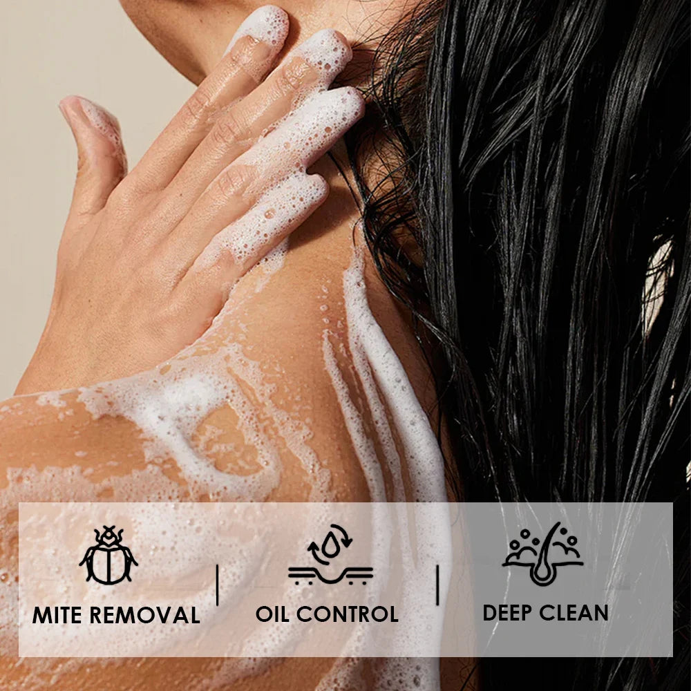 5Pcs Turmeric, Lemon Acid, Kojic Acid Handmade Soap Natural Skincare Bar for Moisturizing And Exfoliating