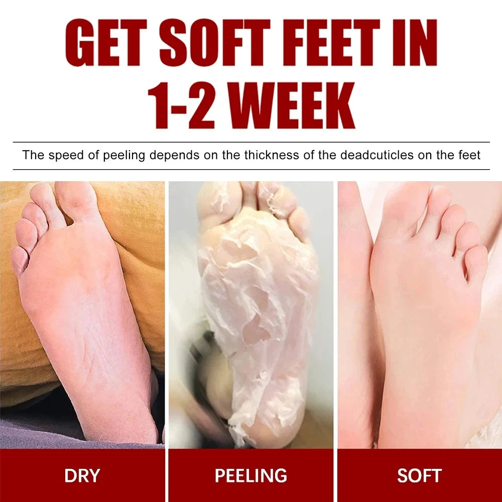 Foot Peeling Mask Repairs Heels & Removes Dry Dead Skin Exfoliating