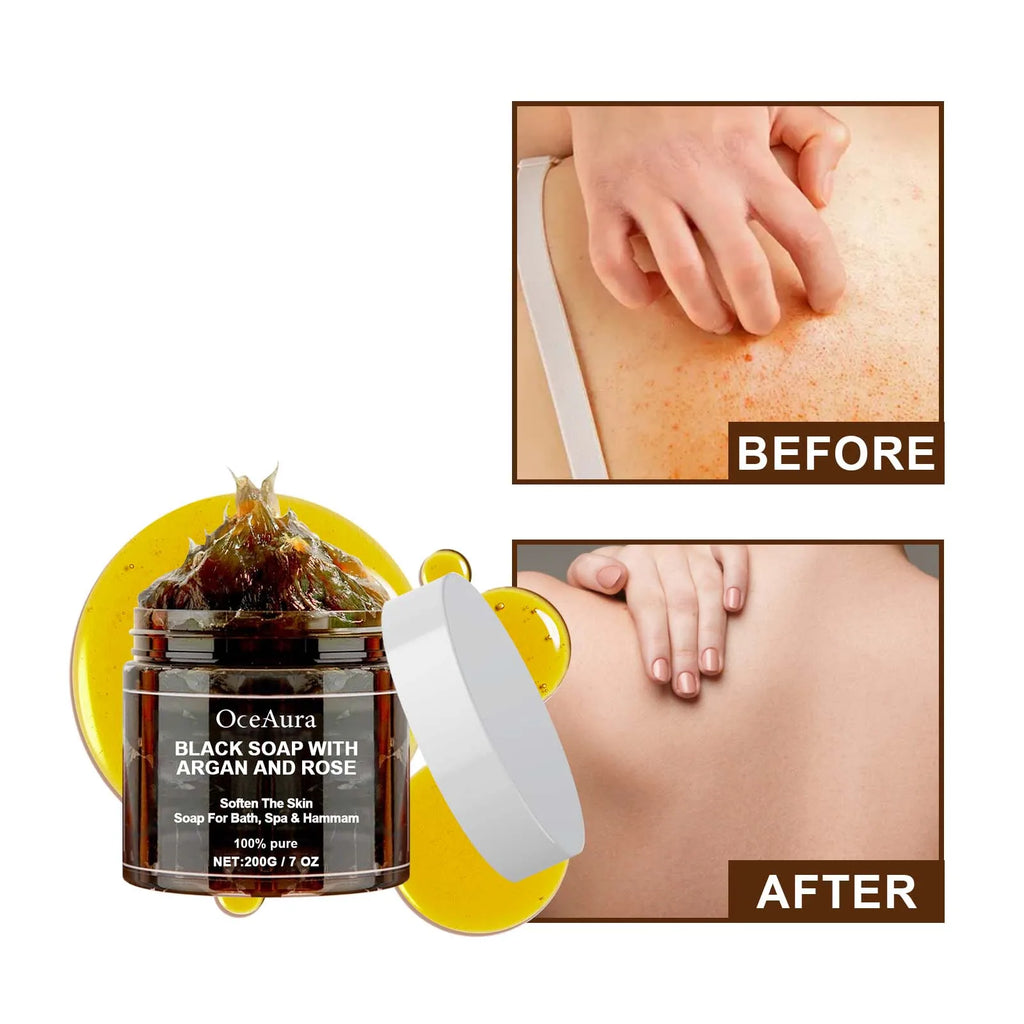 OCEAURA 200g Black Soap With Argan And Rose Body Scrub Purifying Deep Cleansing